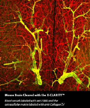Mouse Brain Cleared with the X-CLARITY