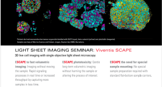 Seminar flyer for the Viventis SCAPE light sheet microscopy system, showing three fluorescent microscopy images of neuroendocrine tumour organoids in cyan, yellow, and magenta. Text highlights three benefits: fast volumetric imaging, reduced phototoxicity, and no special sample mounting required.