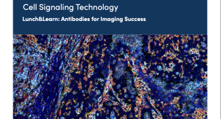 Lunch and Learn on Antibodies for Imaging Success