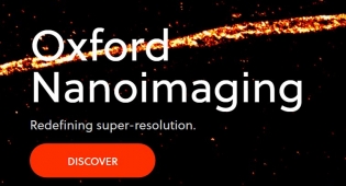 Super resolution, STORM, SIM, confocal, Fluorescent, imaging