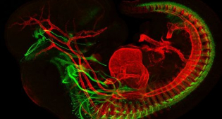 Developing motor neurons and muscles in E11.5 mouse (Jess Bell & Mary Whitman, Engle lab, BCH)