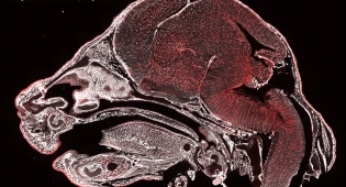 NIF Imaging Contest 2019 neurobiology imaging contest