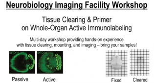 Tissue clearing, Lightsheet Imaging, Workshop