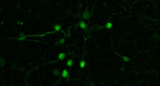 Optics, microscopy, NIF, neurobiology imaging facilty