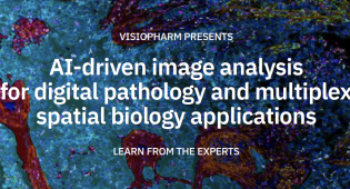 Visiopharm Lunch & Learn AI-driven image analysis for digital pathology & multiplex spatial biology applications