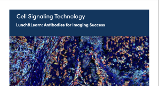 Lunch & Learn - Antibodies for Imaging Success with Cell Signaling